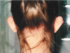 Przed operacjÄ… Przed operacjÄ…