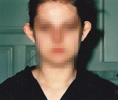 Przed operacjÄ… Przed operacjÄ…